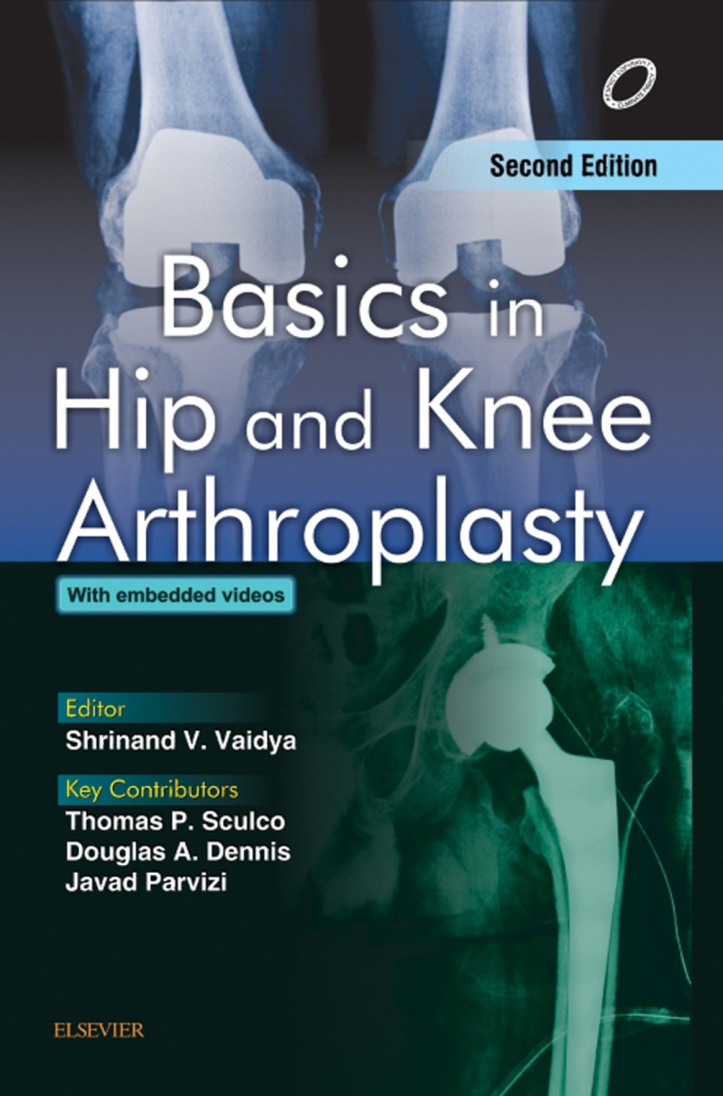 Basics in Hip and Knee Arthroplasty 2nd Edition