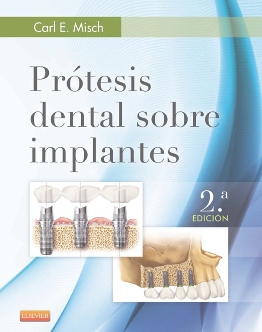 PrÃƒÂ³tesis dental sobre implantes 2nd Edition