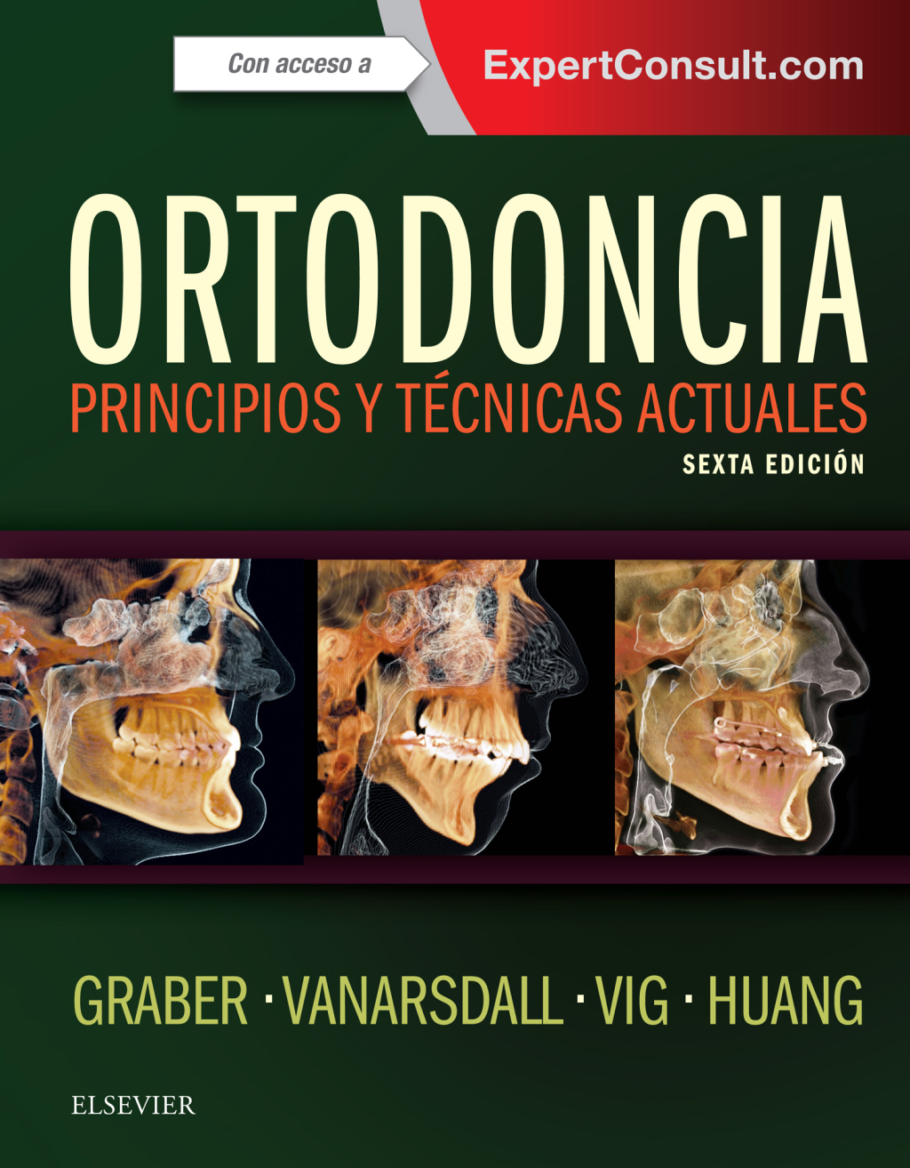 Ortodoncia Principios y tÃƒÂ©cnicas actuales 6th Edition