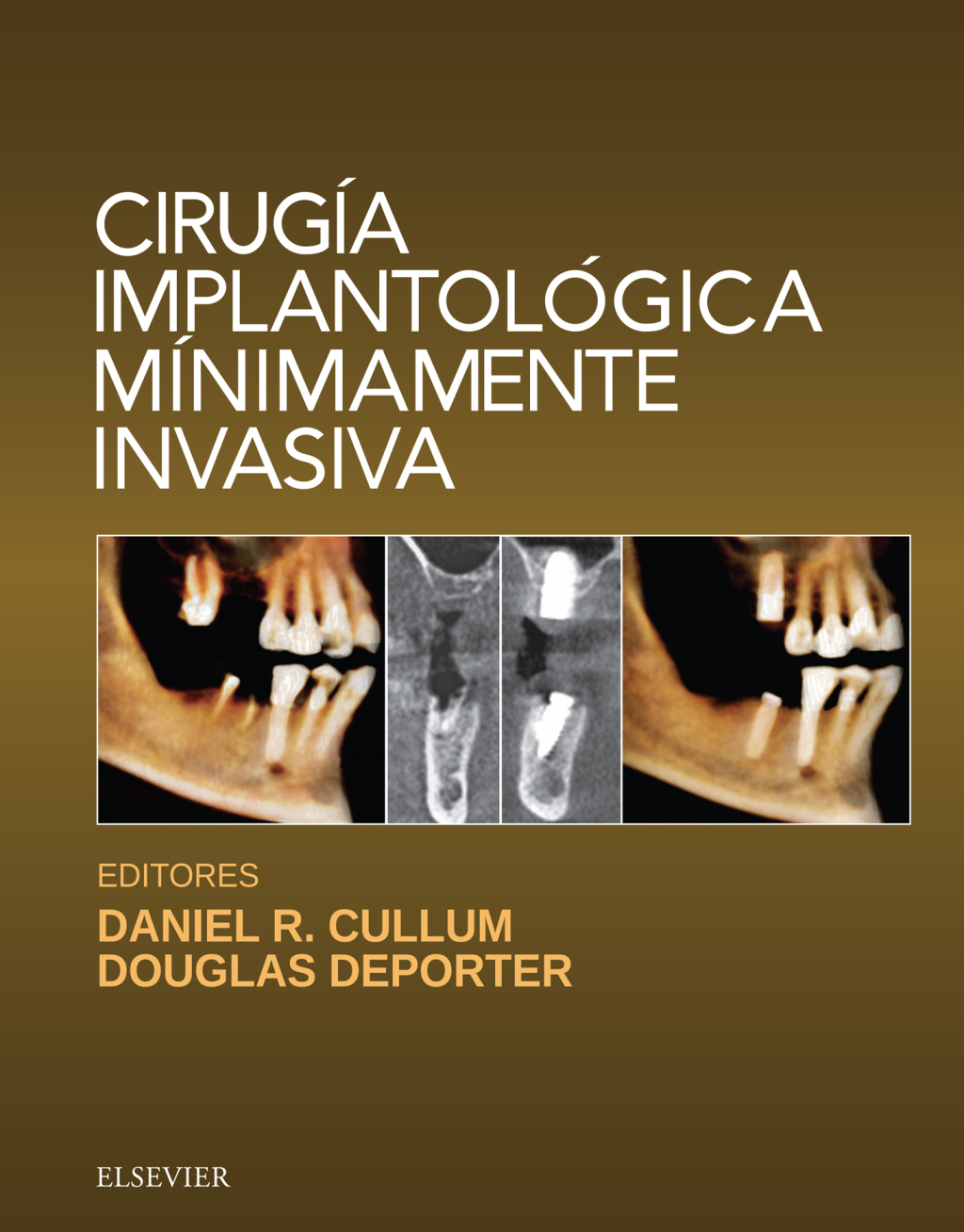 CirugÃƒÂ­a implantolÃƒÂ³gica mÃƒÂ­nimamente invasiva 