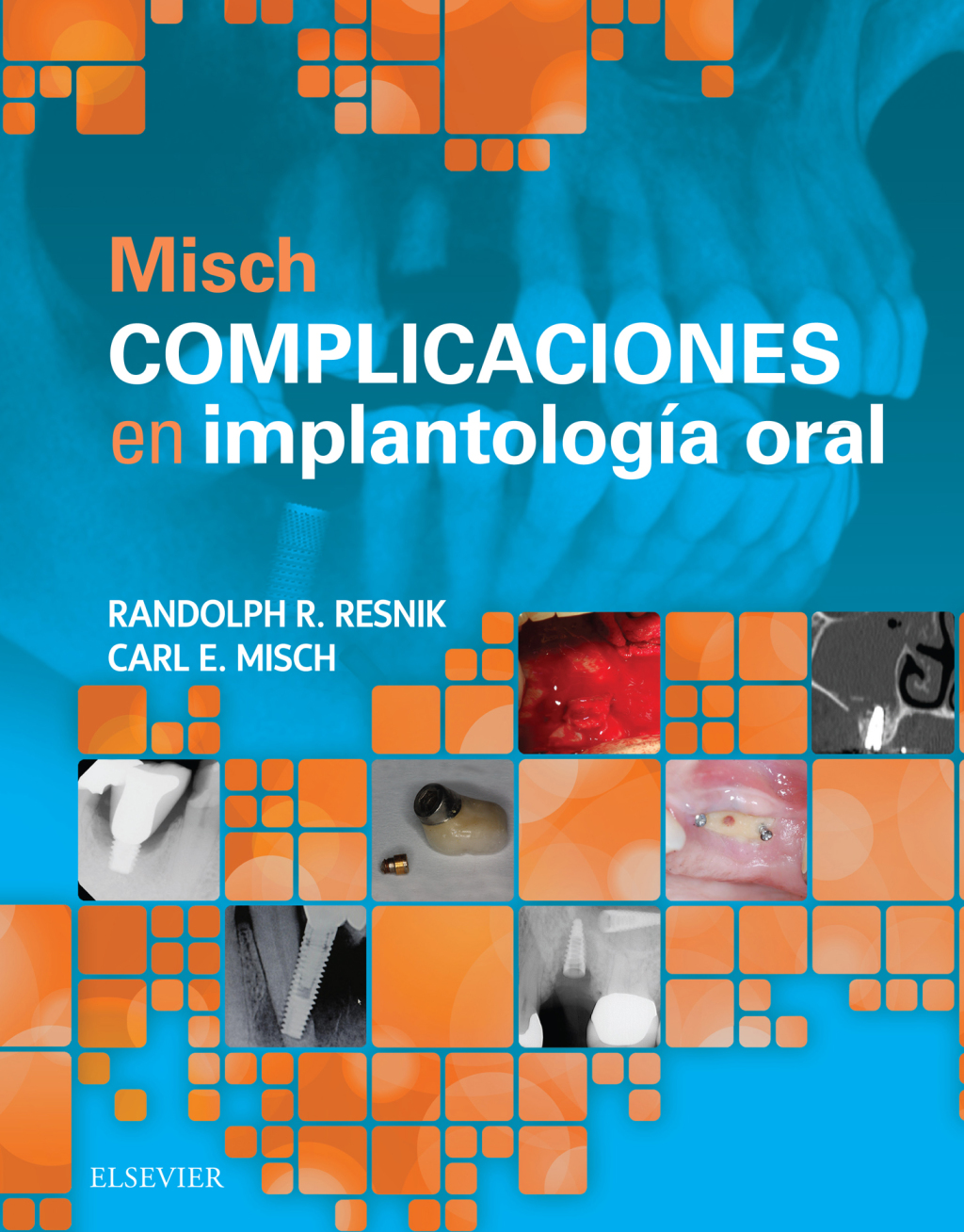 Misch. Complicaciones en implantologÃƒÂ­a oral 