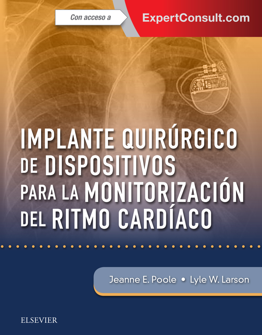 Implante quirÃƒÂºrgico de dispositivos para la monitorizaciÃƒÂ³n del ritmo cardÃƒÂ­aco 