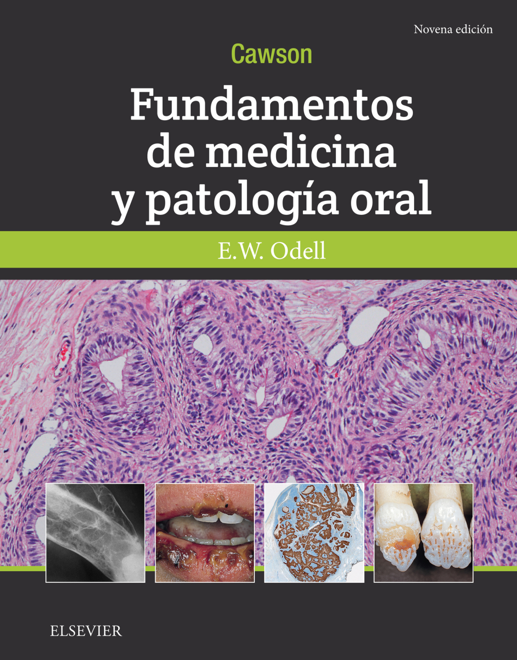 Cawson.Fundamentos de medicina y patologÃƒÂ­a oral 9th Edition