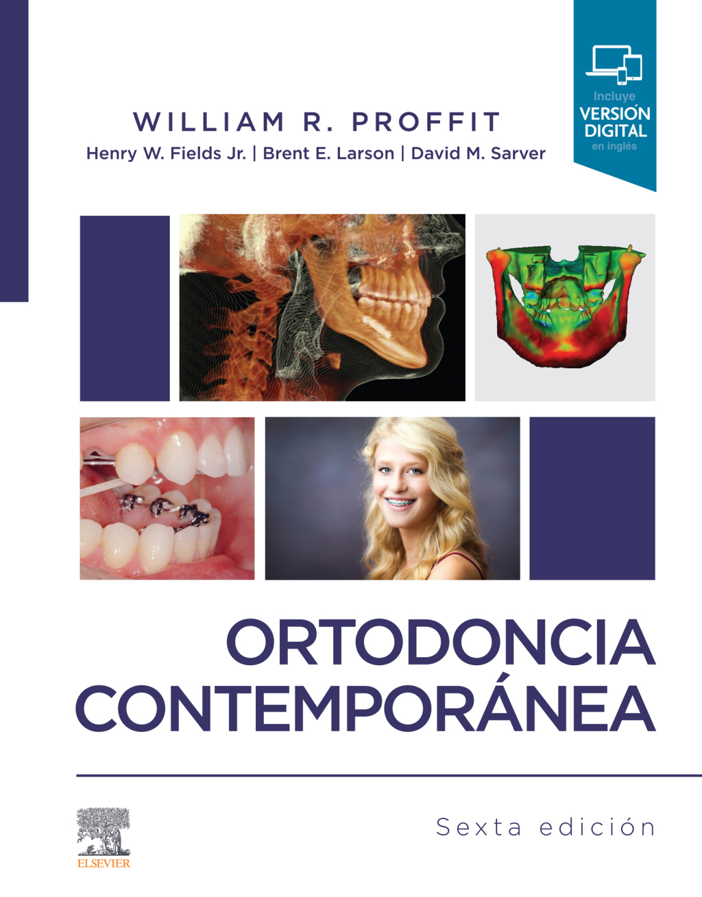 Ortodoncia contemporÃƒÂ¡nea 6th Edition