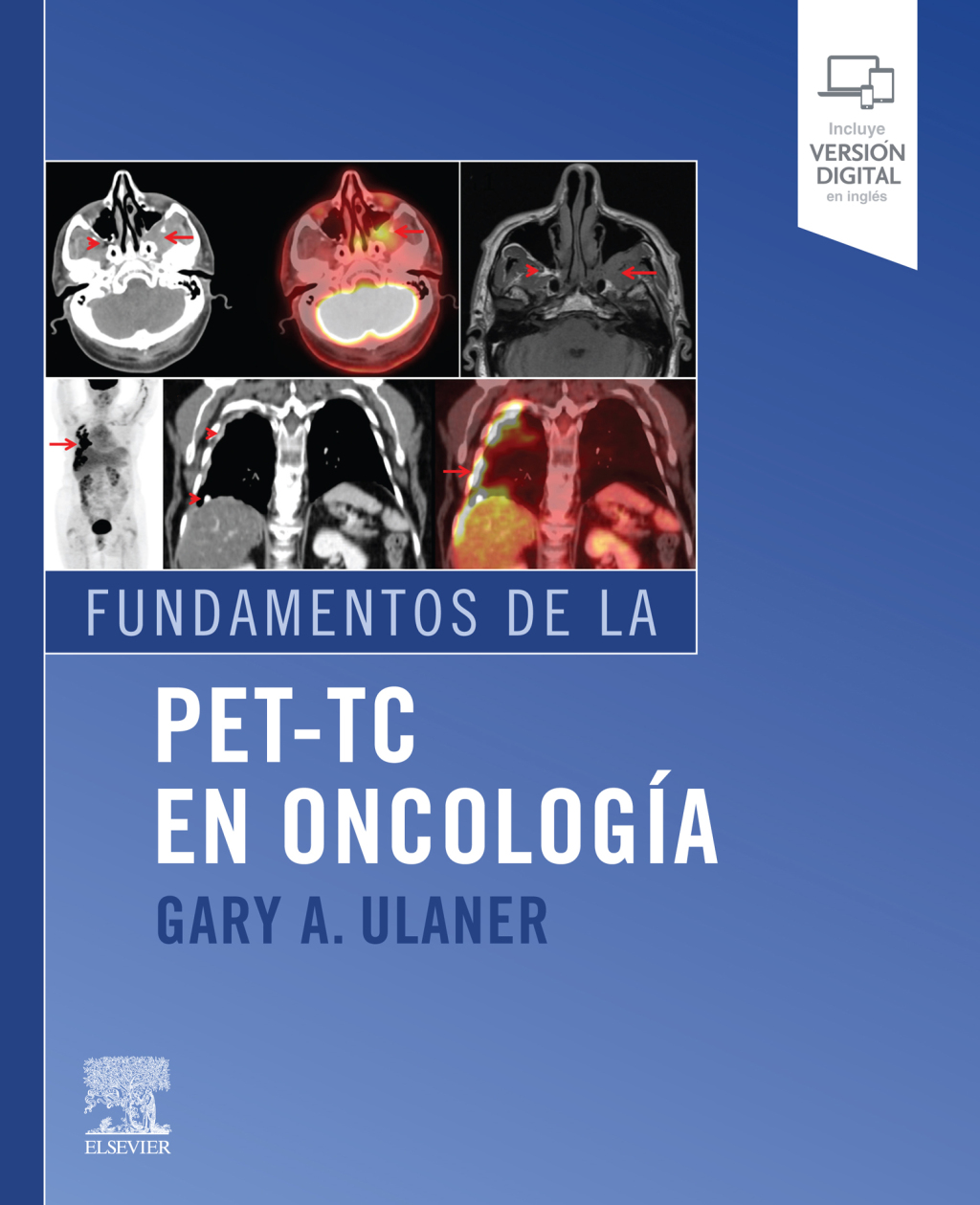 Fundamentos de la PET-TC en oncologÃƒÂ­a 