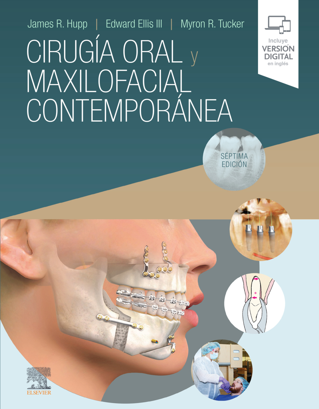 CirugÃƒÂ­a oral y maxilofacial contemporÃƒÂ¡nea 7th Edition