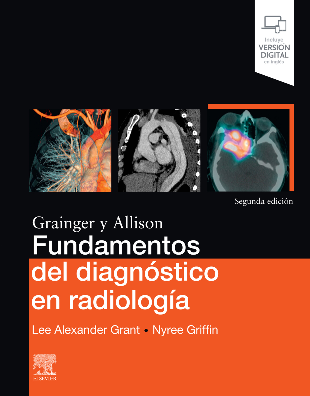 Fundamentos del diagnÃƒÂ³stico en radiologÃƒÂ­a 2nd Edition