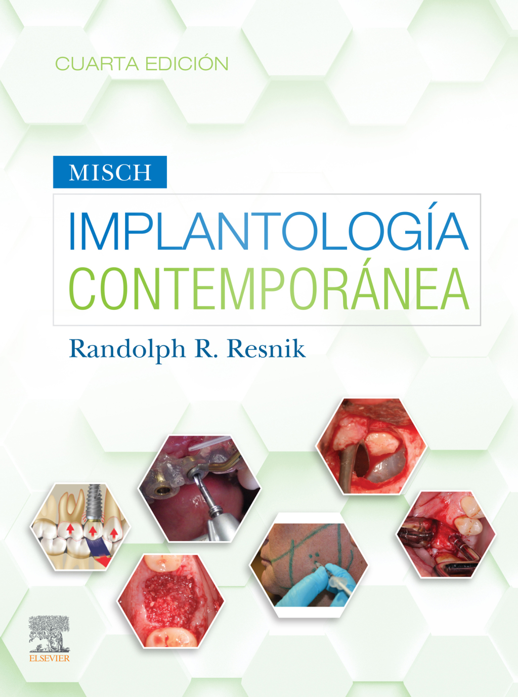 Misch. ImplantologÃƒÂ­a contemporÃƒÂ¡nea 4th Edition