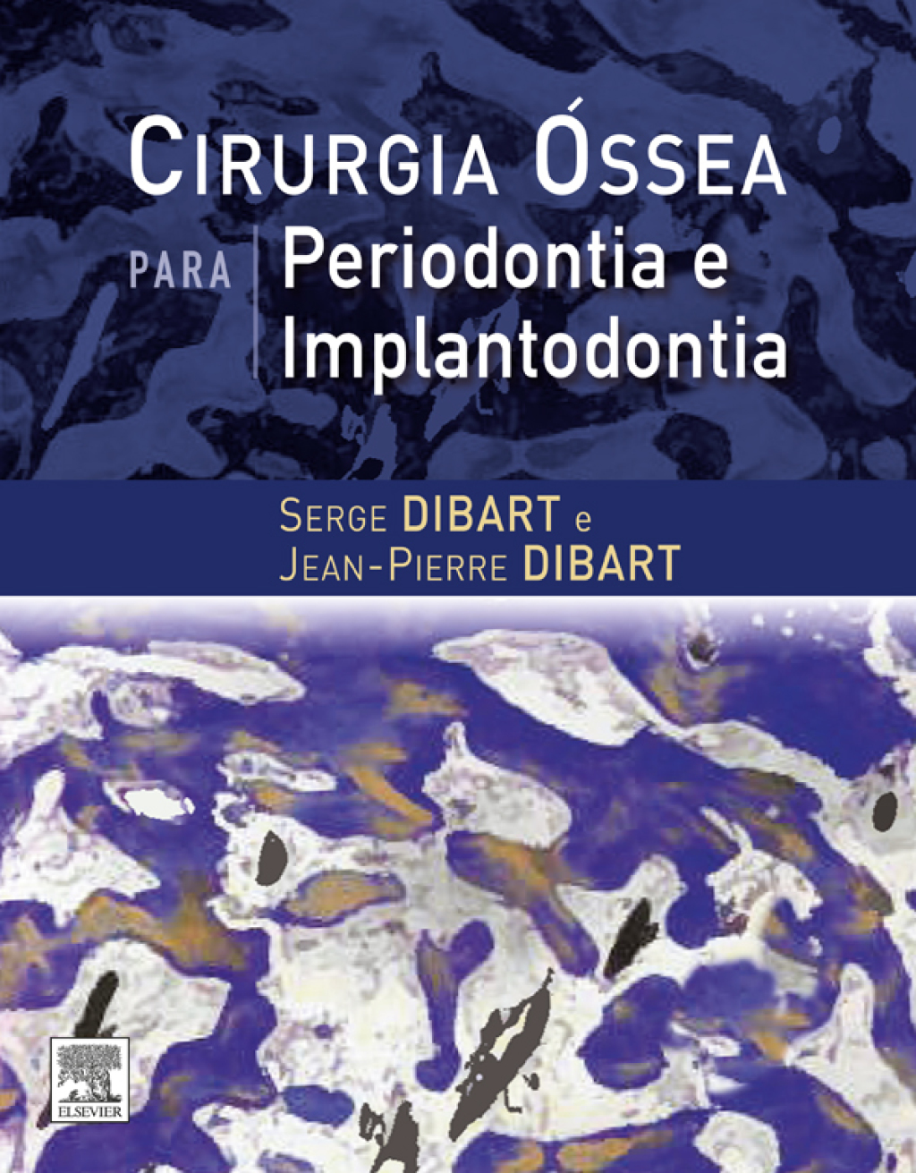Cirurgia Ãƒâ€œssea para Periodontia e Implantodontia 