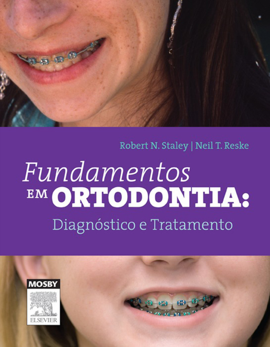 Fundamentos em Ortodontia: DiagnÃƒÂ³stico e Tratamento 