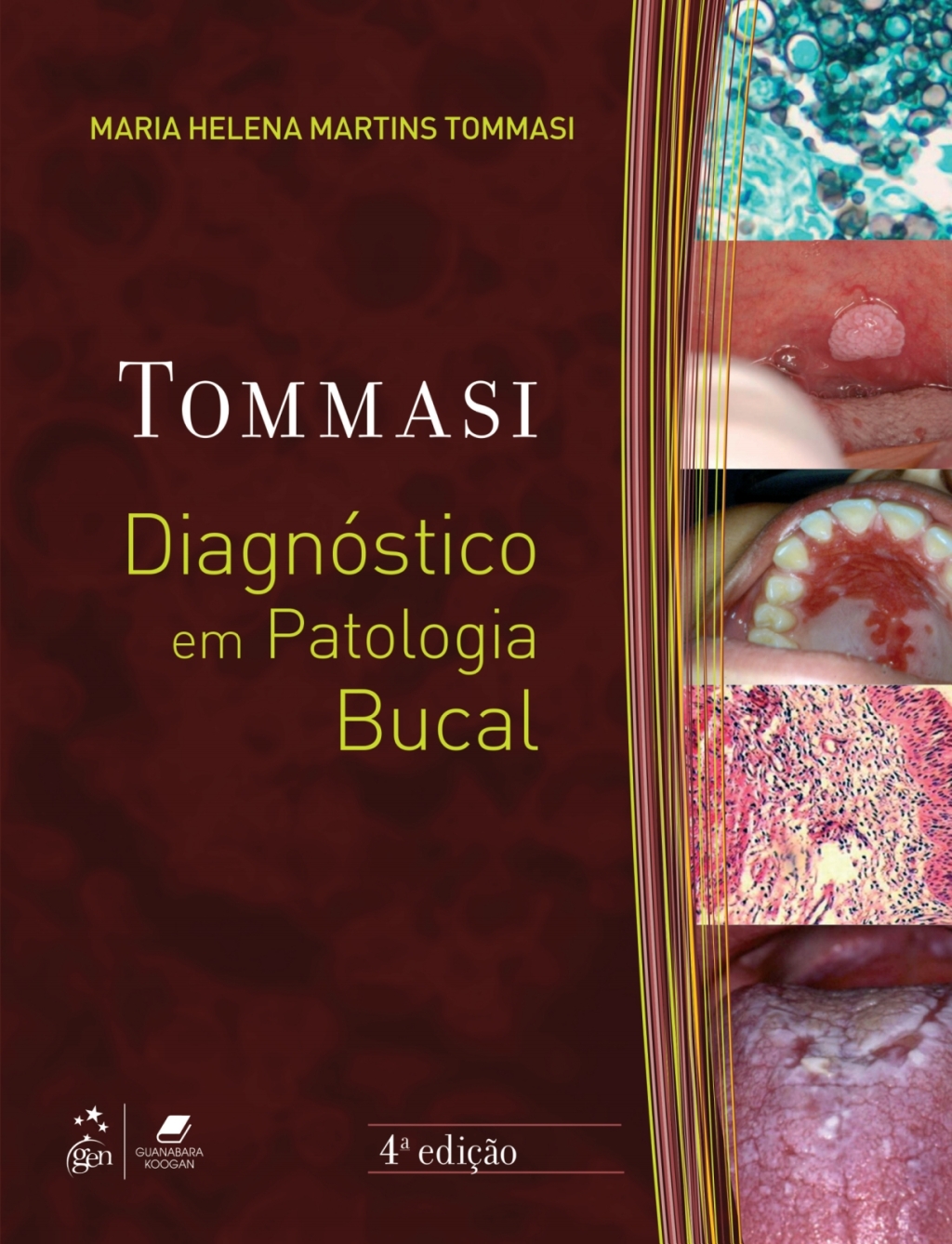 DiagnÃƒÂ³stico em Patologia Bucal 4th Edition
