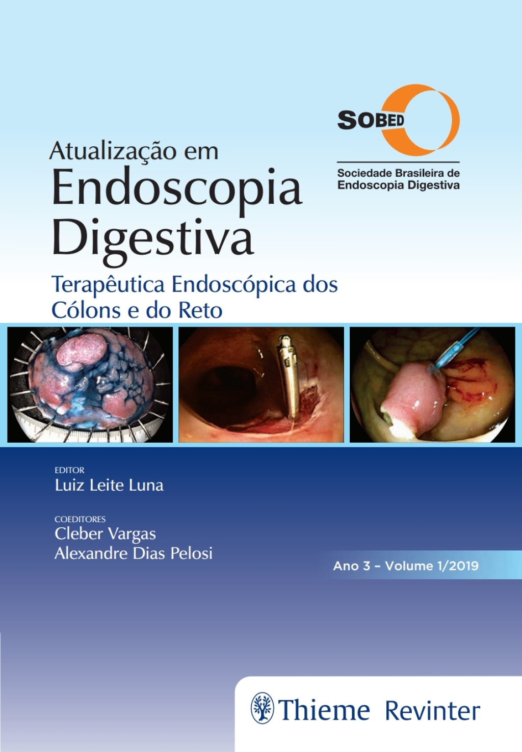 AtualizaÃƒÂ§ÃƒÂ£o em Endoscopia Digestiva: TerapÃƒÂªutica EndoscÃƒÂ³pica dos CÃƒÂ³lons e do Reto 1st Edition