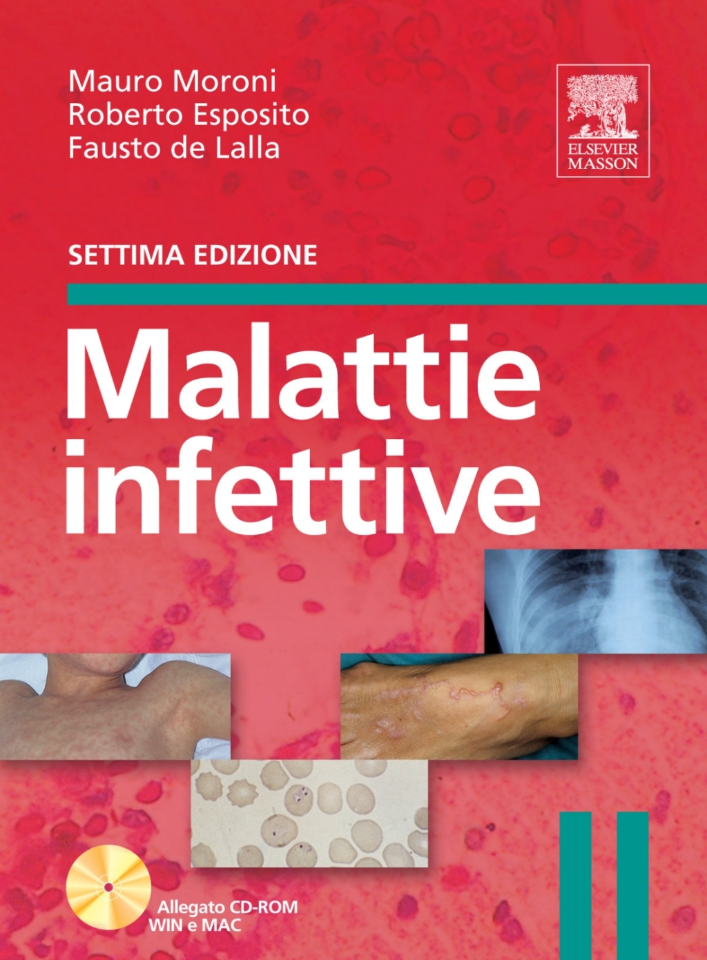 Malattie infettive 7th Edition