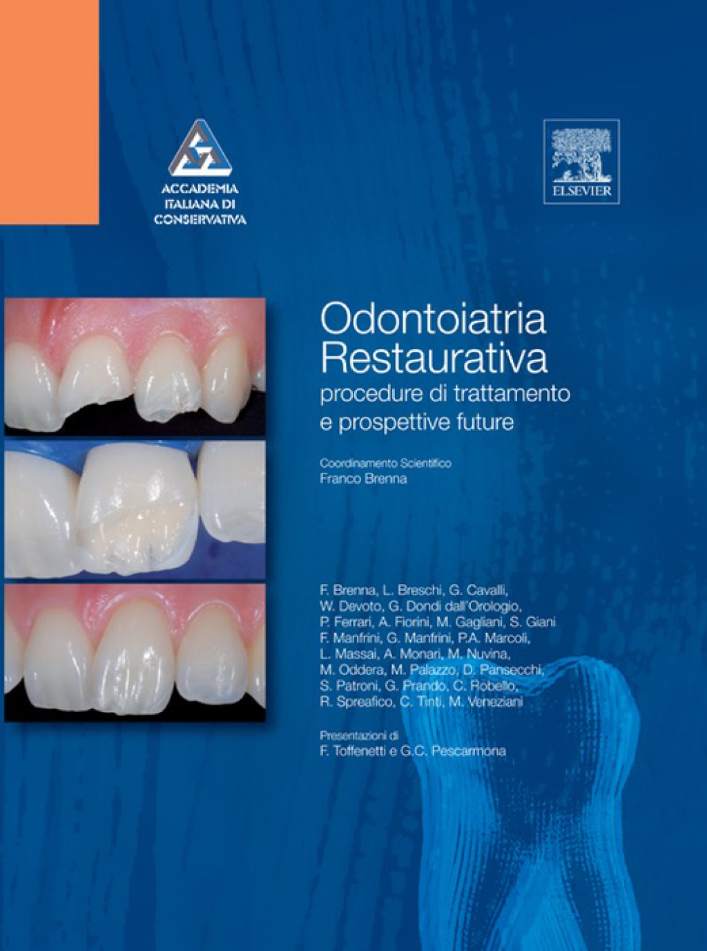 Odontoiatria restaurativa Procedure di trattamento e prospettive future 1st Edition