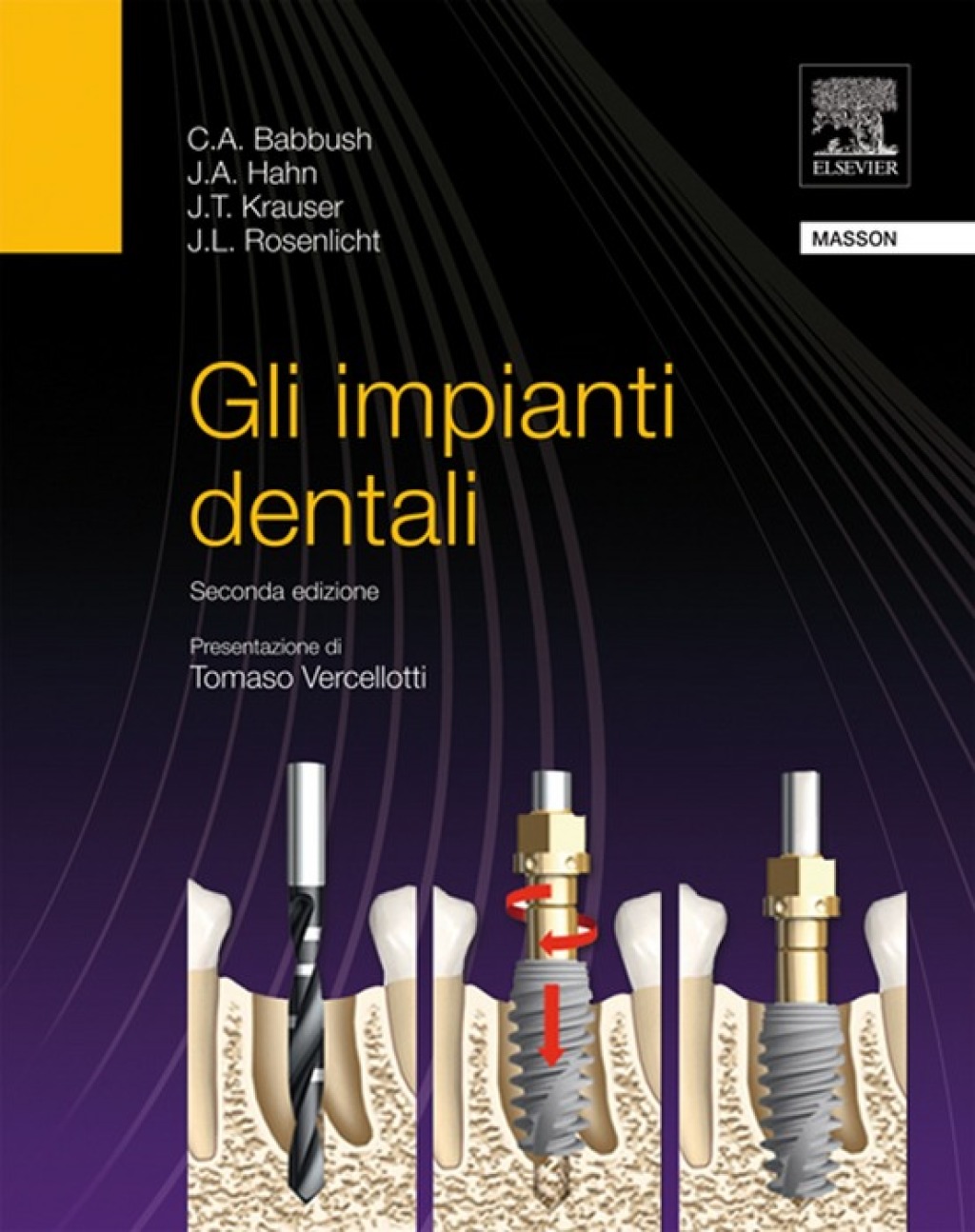 Gli impianti dentali 2nd Edition