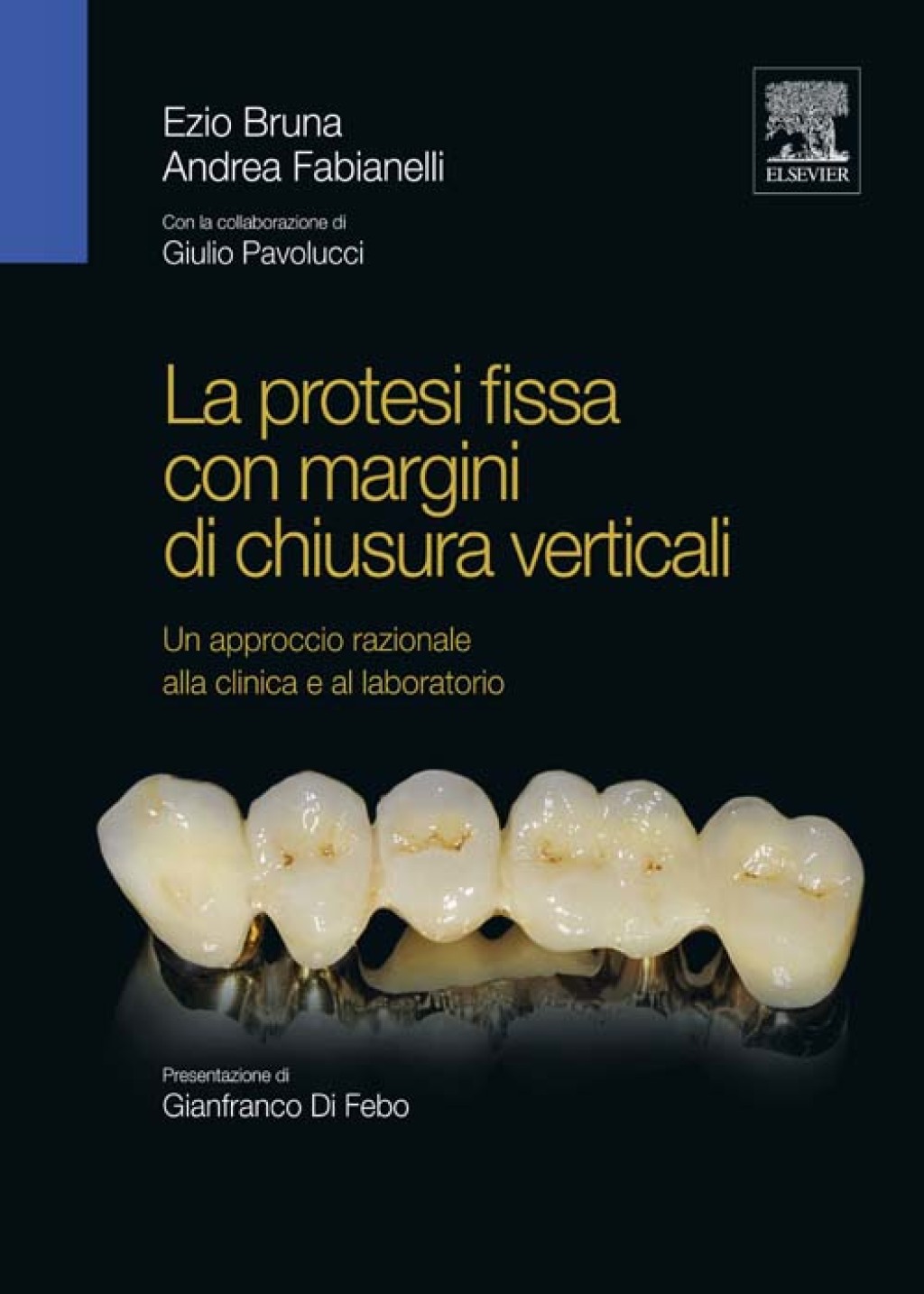 La protesi fissa con margini di chiusura verticali Un approccio razionale alla clinica e al laboratorio 