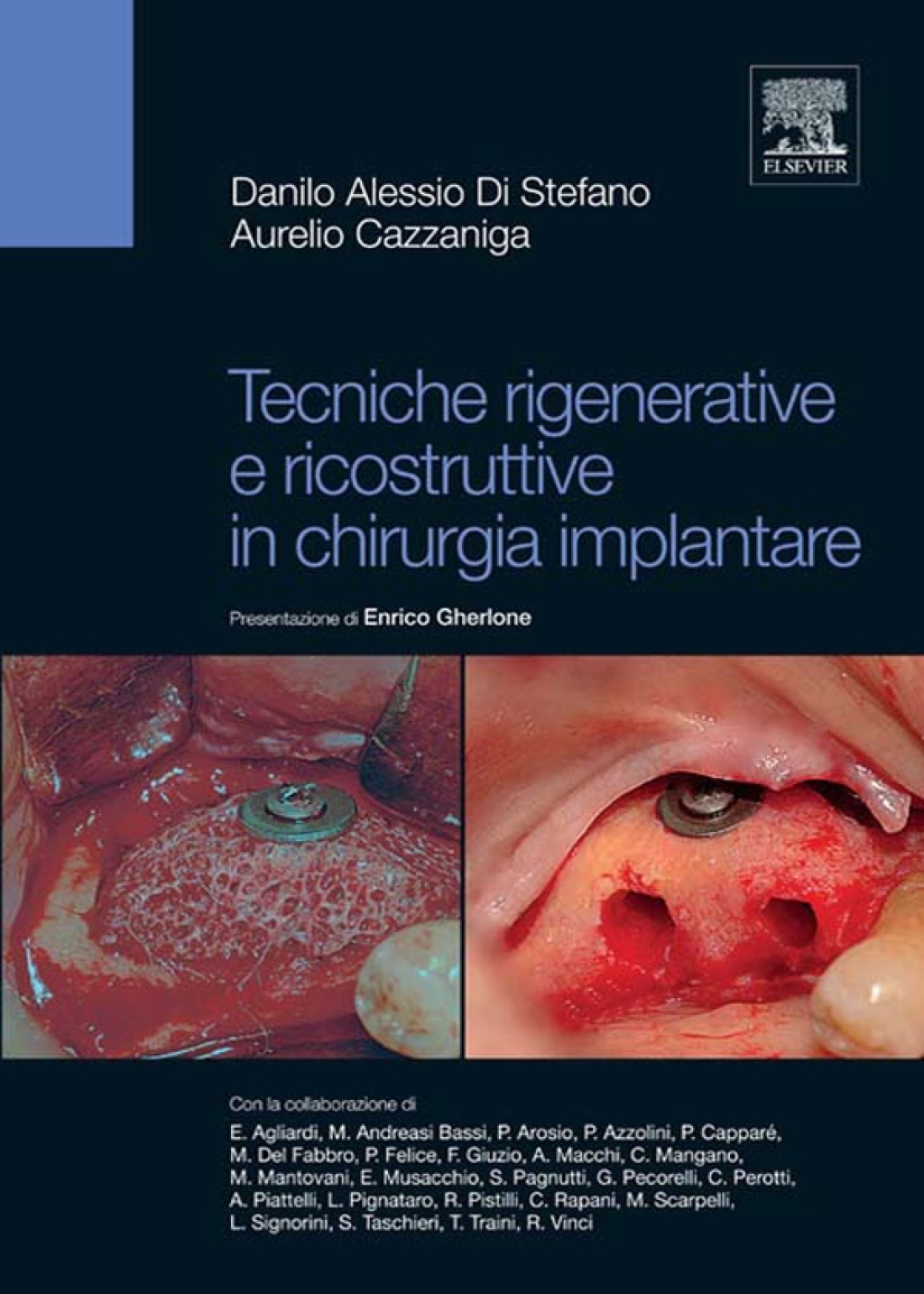 Tecniche rigenerative e ricostruttive in chirurgia implantare 
