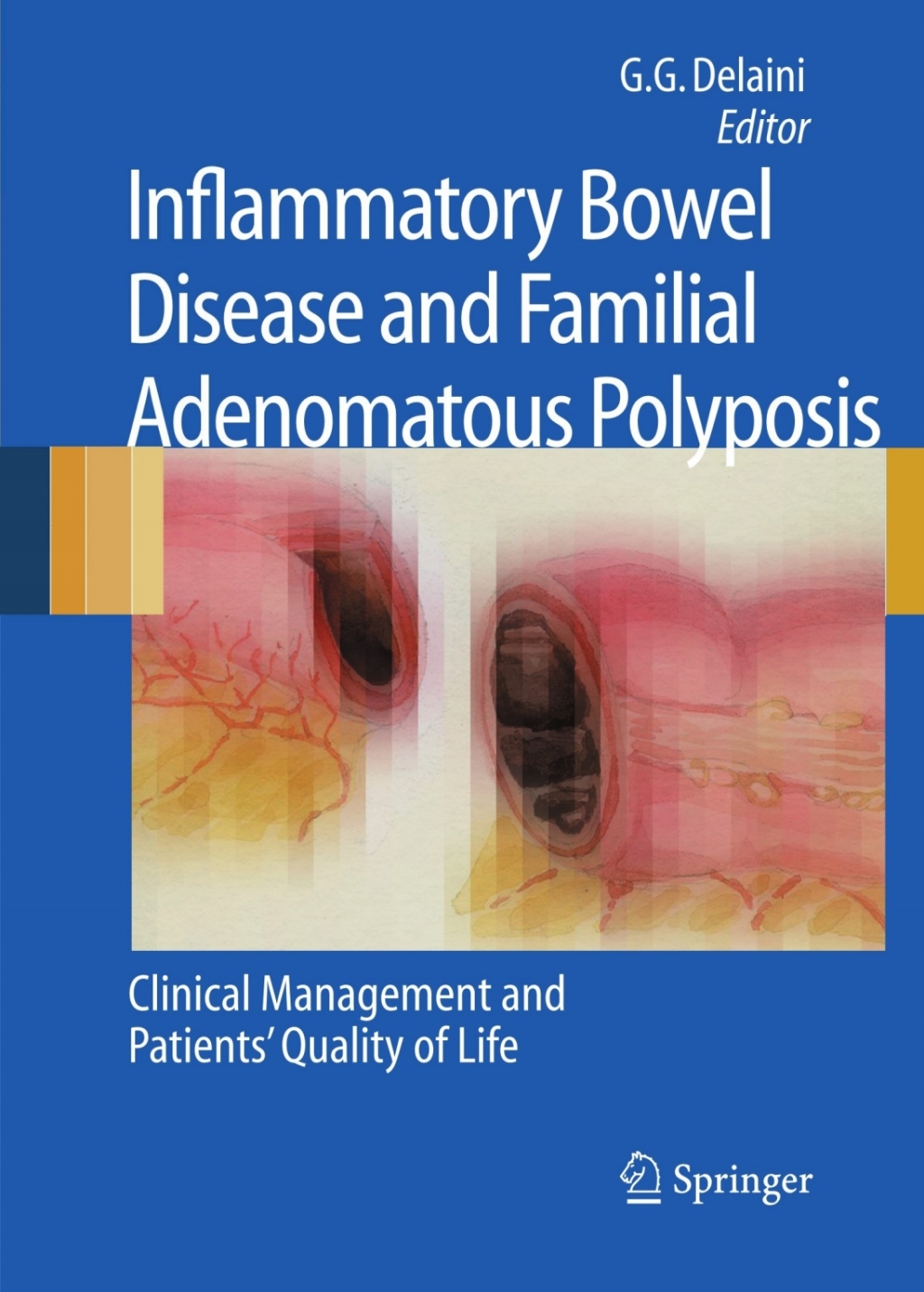 Inflammatory Bowel Disease and Familial Adenomatous Polyposis Clinical Management and Patients' Quality of Life 1st Edition