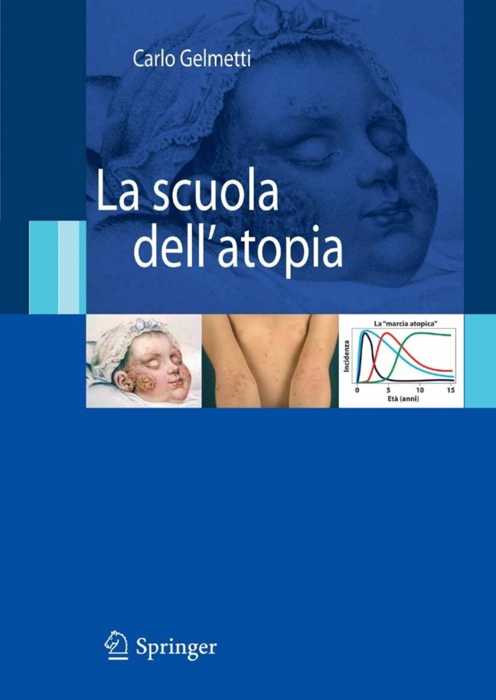 La scuola dell'atopia 
