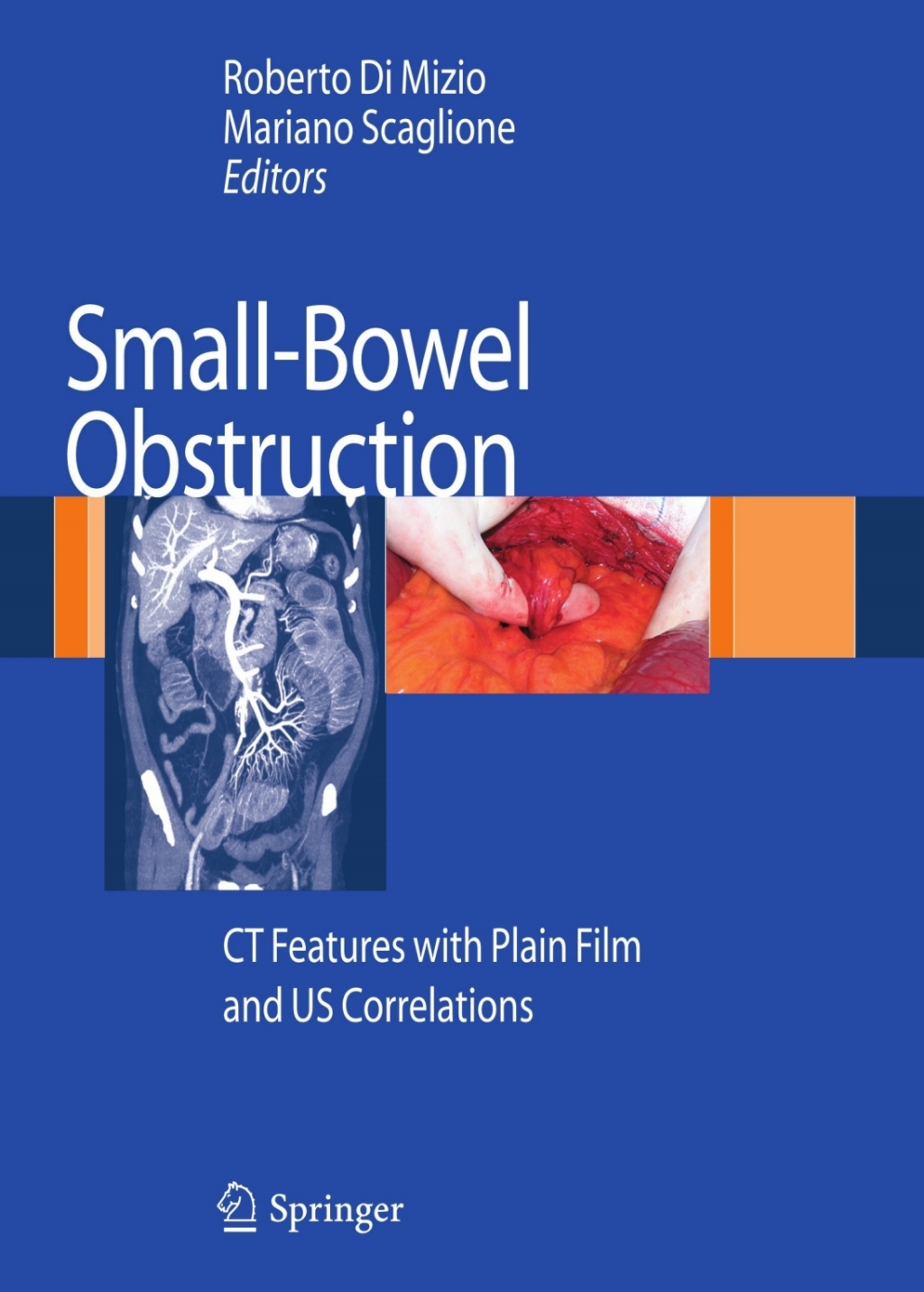 Small-Bowel Obstruction CT Features with Plain Film and US correlations 1st Edition