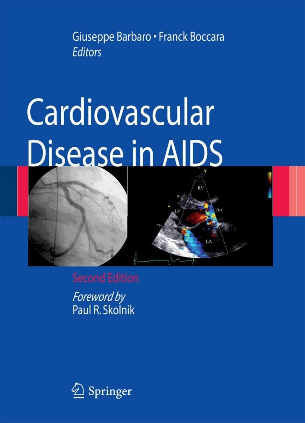 Cardiovascular Disease in AIDS 2nd Edition