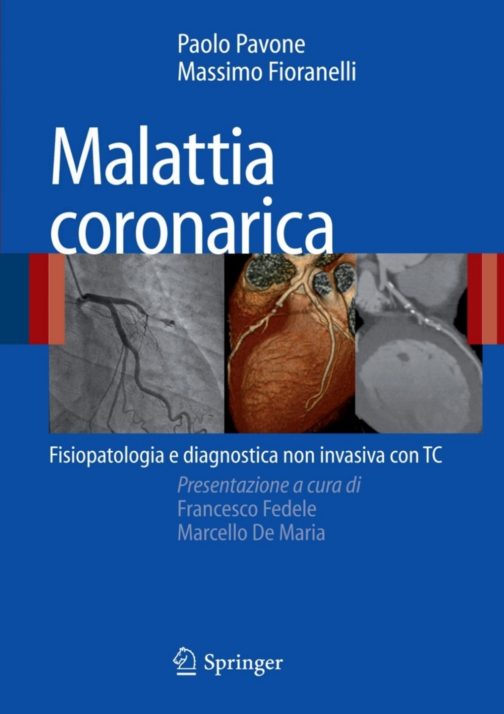 Malattia coronarica Fisiopatologia e diagnostica non invasiva con TC 