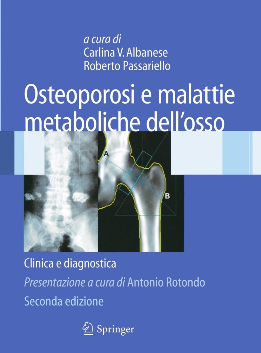 Osteoporosi e malattie metaboliche dell'osso Clinica e diagnostica 2nd Edition