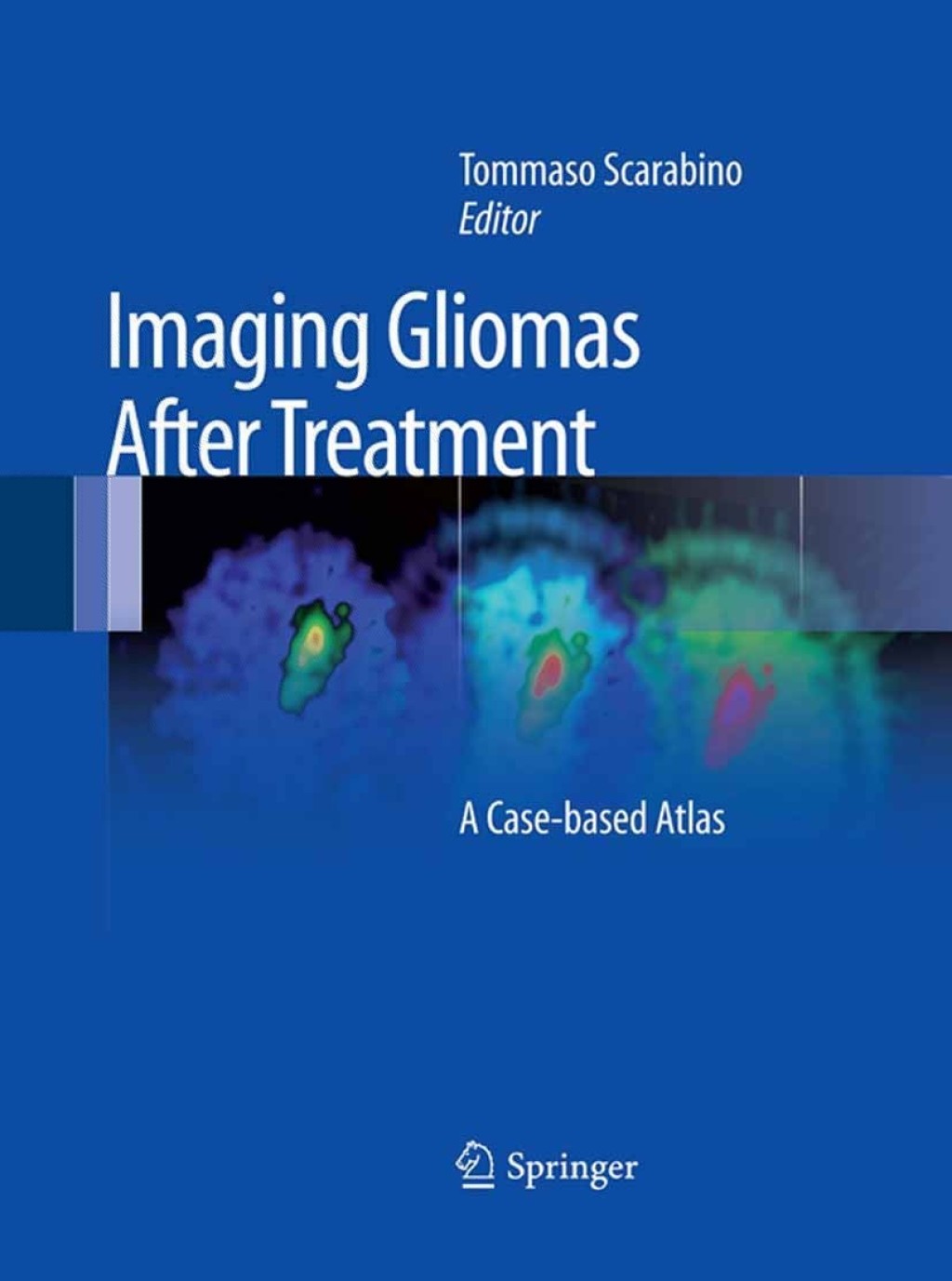Imaging Gliomas After Treatment A Case-based Atlas 1st Edition