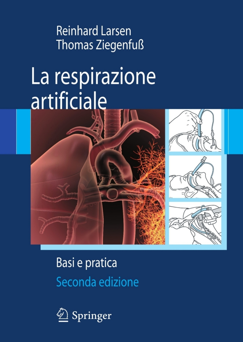 La respirazione artificiale Basi e pratica 2nd Edition