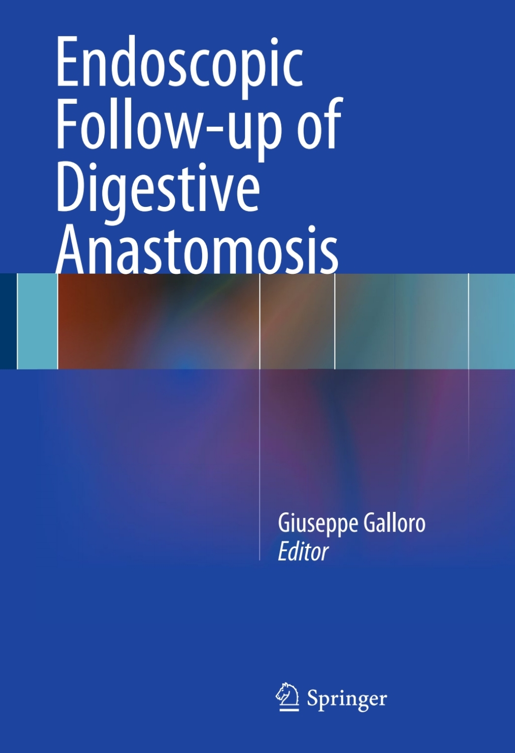 Endoscopic Follow-up of Digestive Anastomosis 