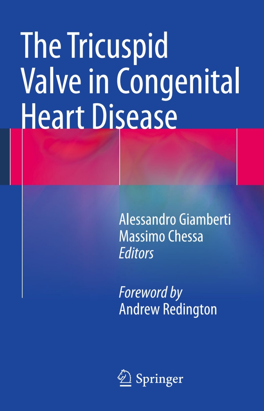 The Tricuspid Valve in Congenital Heart Disease 