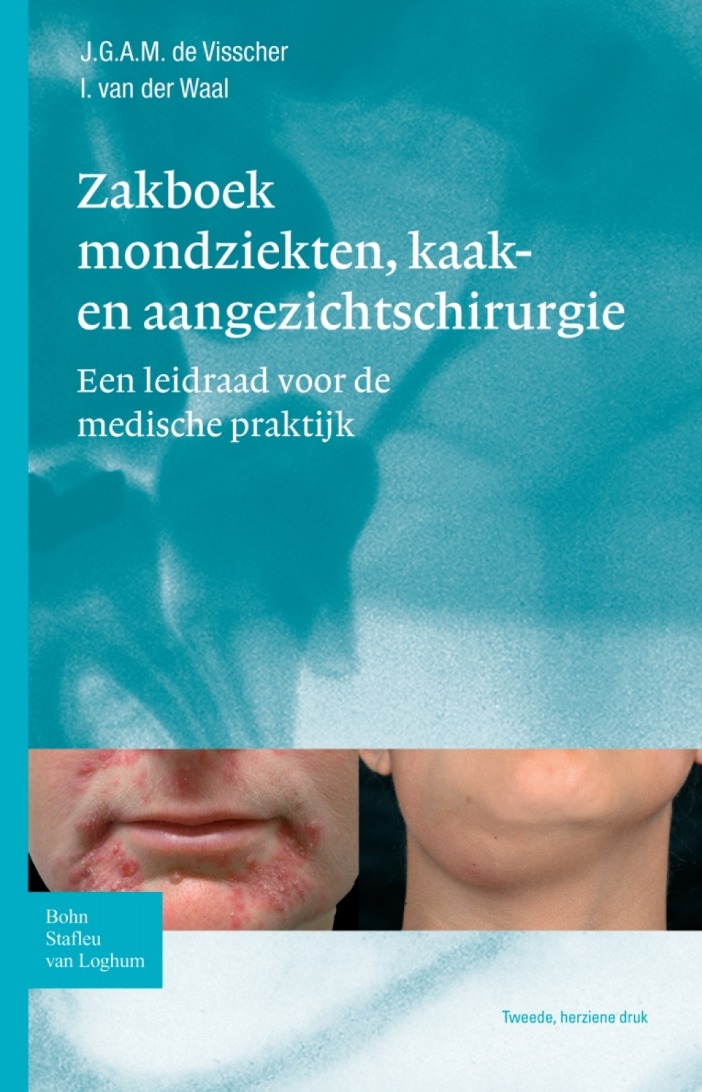 Zakboek mondziekten, kaak- en aangezichtschirurgie Een leidraad voor de medische praktijk 2nd Edition