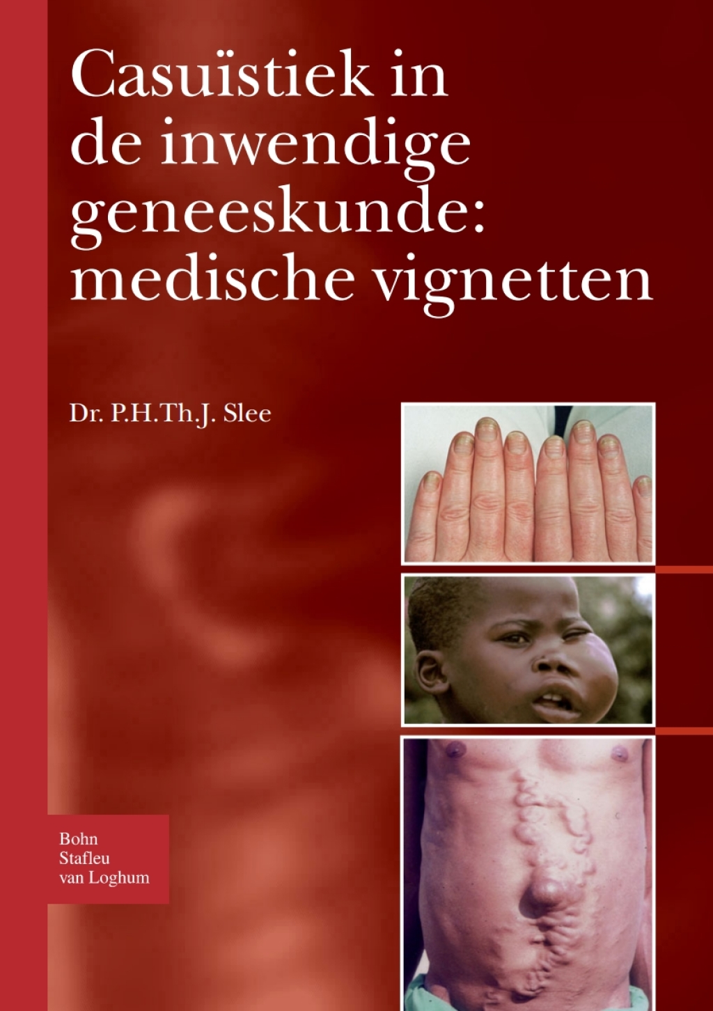 CasuÃƒÂ¯stiek in de inwendige geneeskunde: medische vignetten 