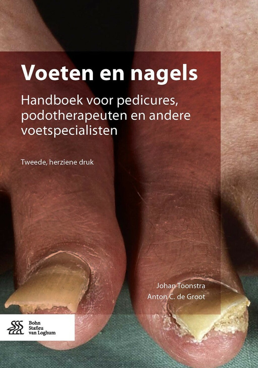 Voeten en nagels Handboek voor pedicures, podotherapeuten en andere voetspecialisten 2nd Edition