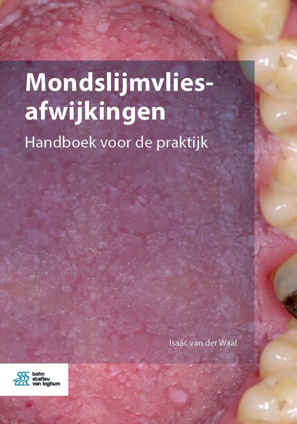 Mondslijmvliesafwijkingen Handboek voor de praktijk 
