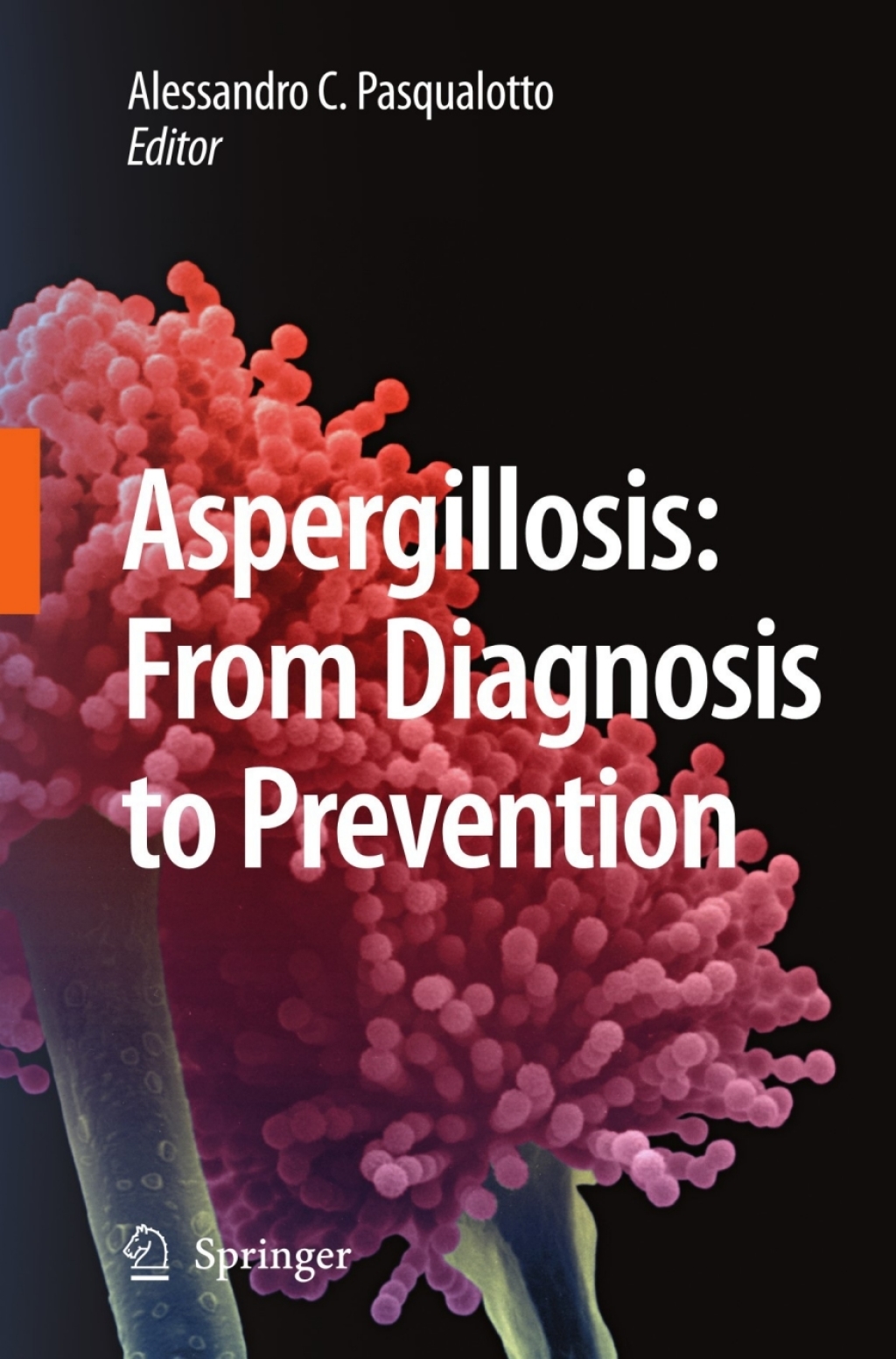 Aspergillosis: from diagnosis to prevention 1st Edition