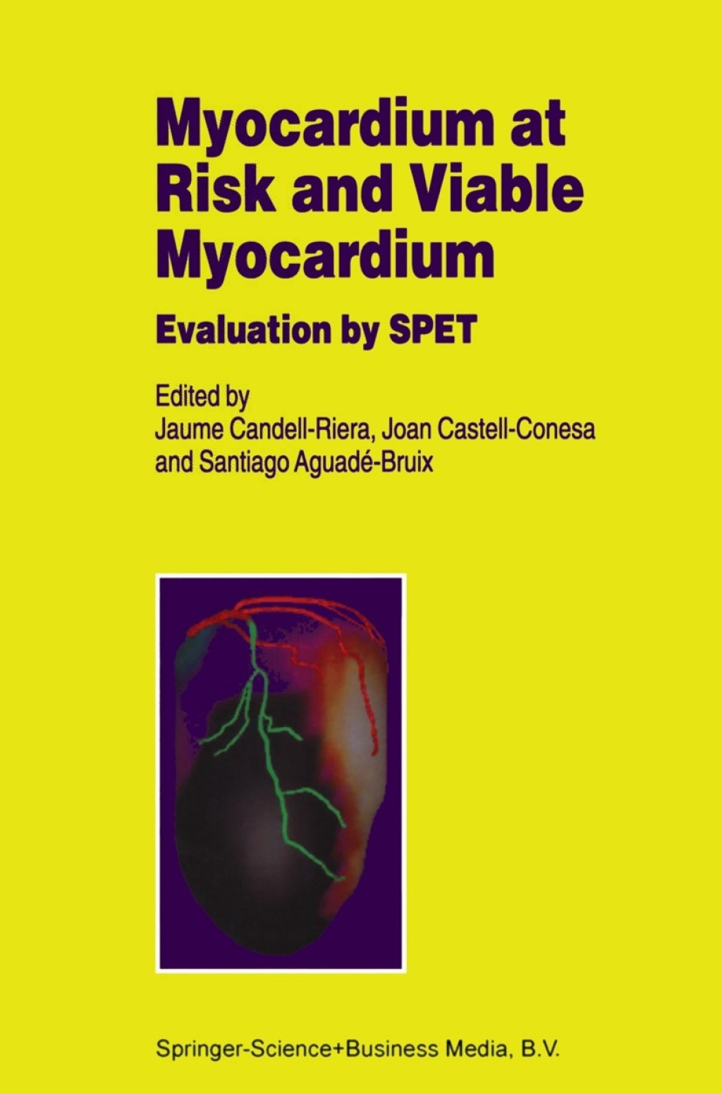 Myocardium at Risk and Viable Myocardium Evaluation by SPET 1st Edition