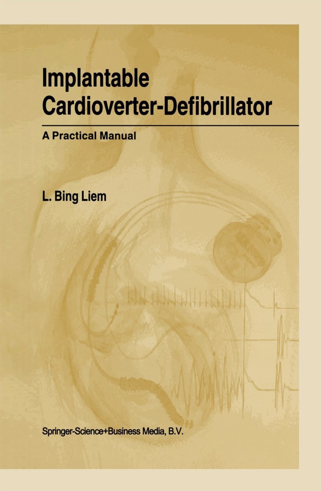 Implantable Cardioverter-Defibrillator A Practical Manual 