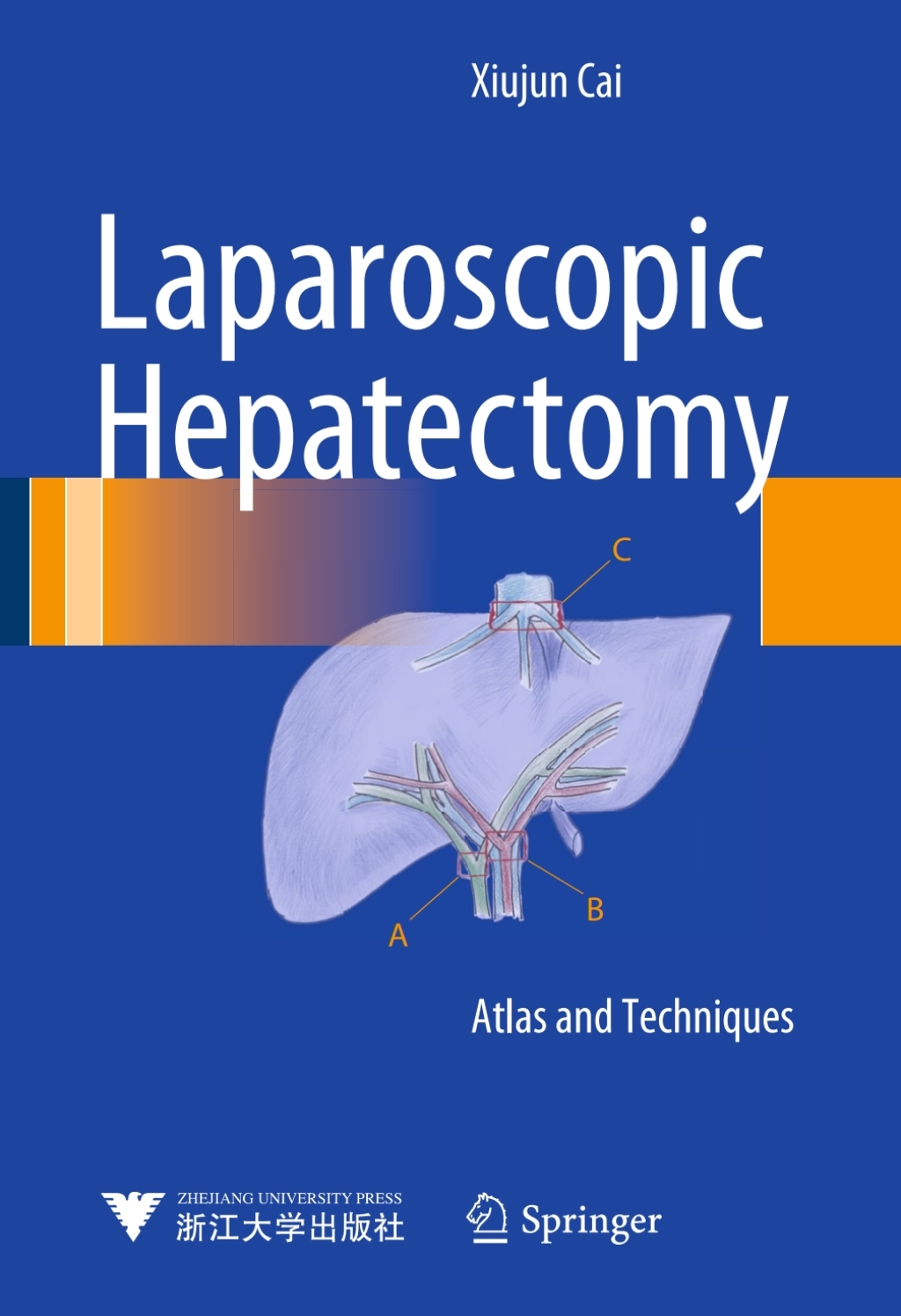 Laparoscopic Hepatectomy Atlas and Techniques 