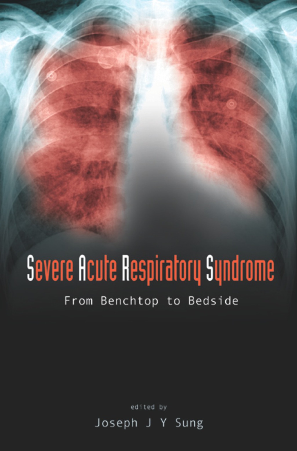 SEVERE ACUTE RESPIRATORY SYNDROME From Benchtop to Bedside 