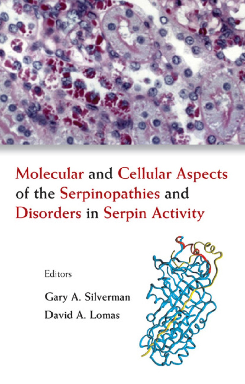 Molecular And Cellular Aspects Of The Serpinopathies And Disorders In Serpin Activity 