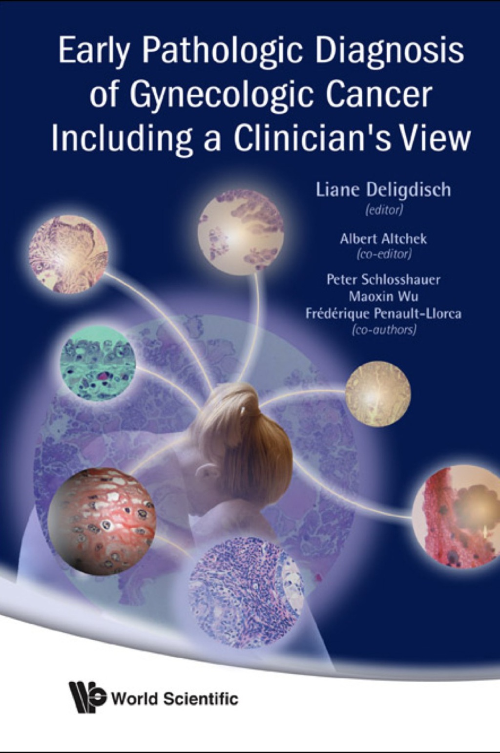 Early Pathologic Diagnosis of Gynecologic Cancer Including a Clinician's View 