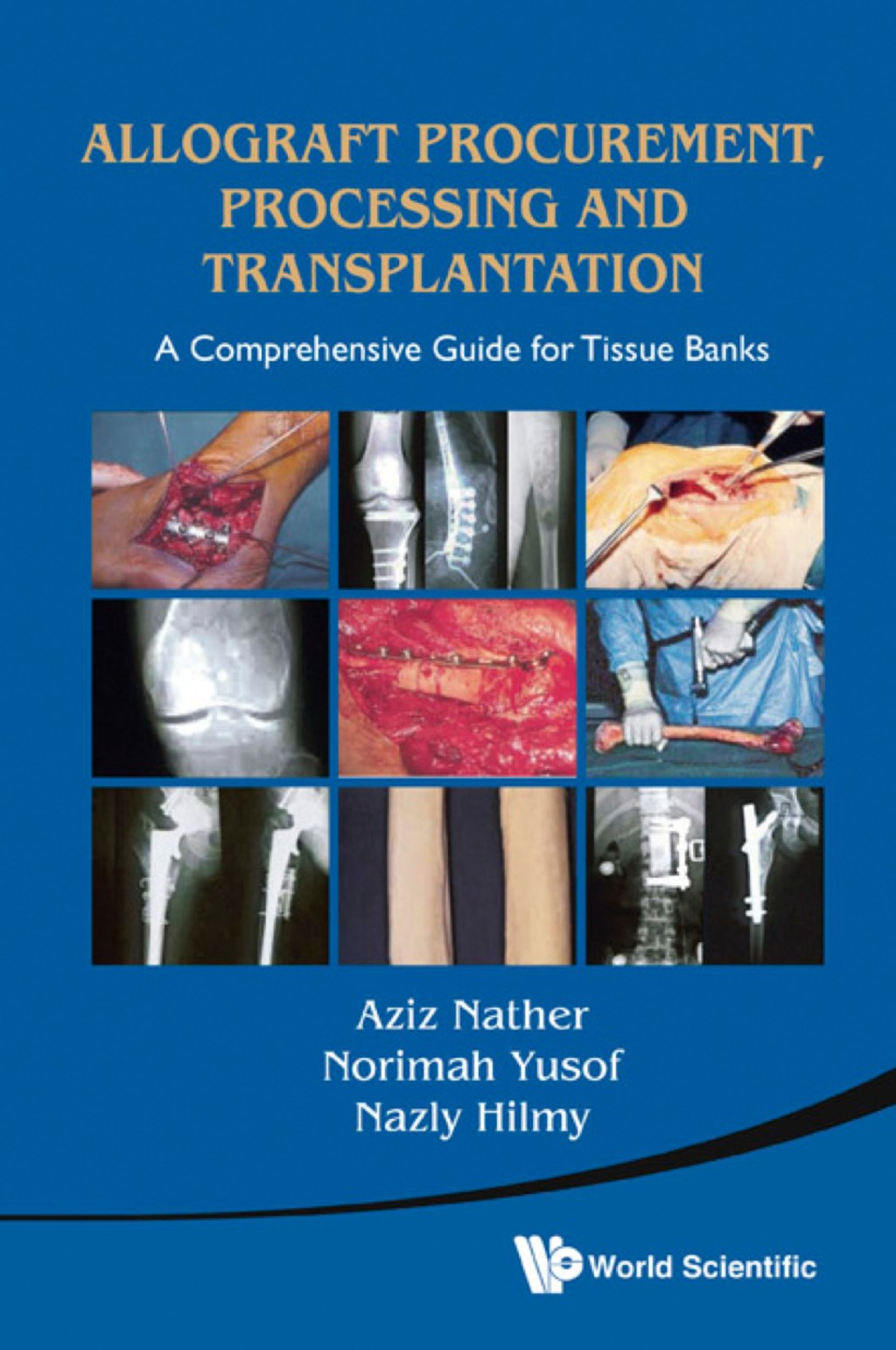 Allograft Procurement, Processing and Transplantation: A Comprehensive Guide for Tissue Banks 