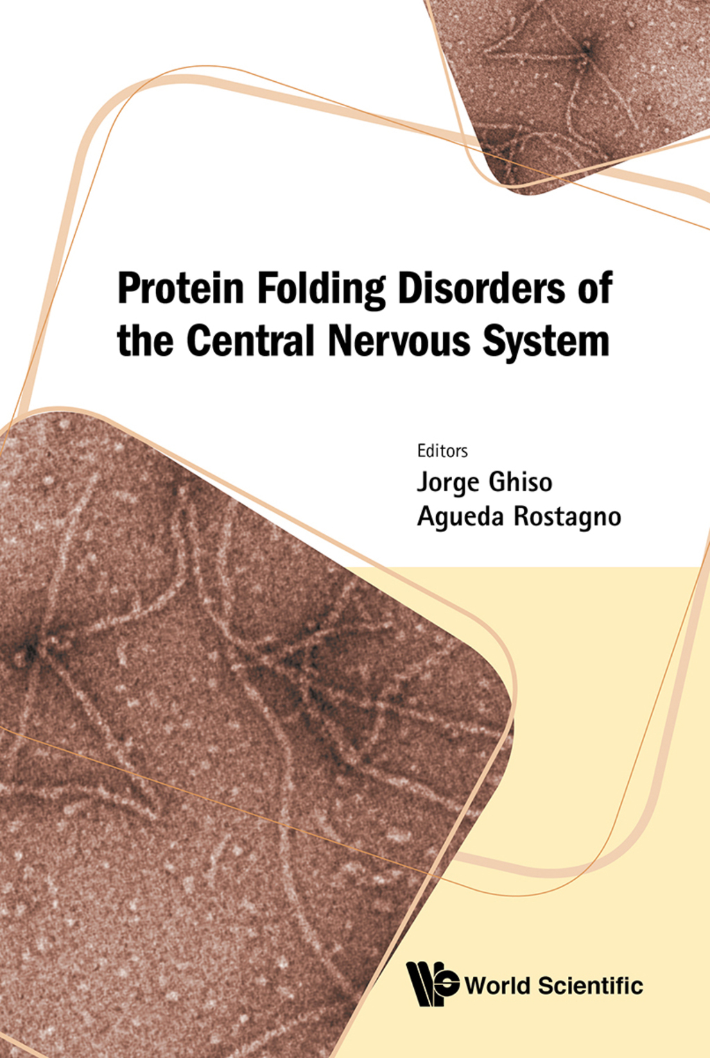 Protein Folding Disorders of the Central Nervous System 
