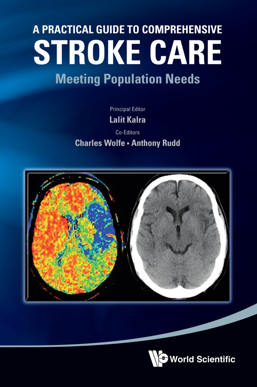 Practical Guide To Comprehensive Stroke Care, A: Meeting Population Needs 
