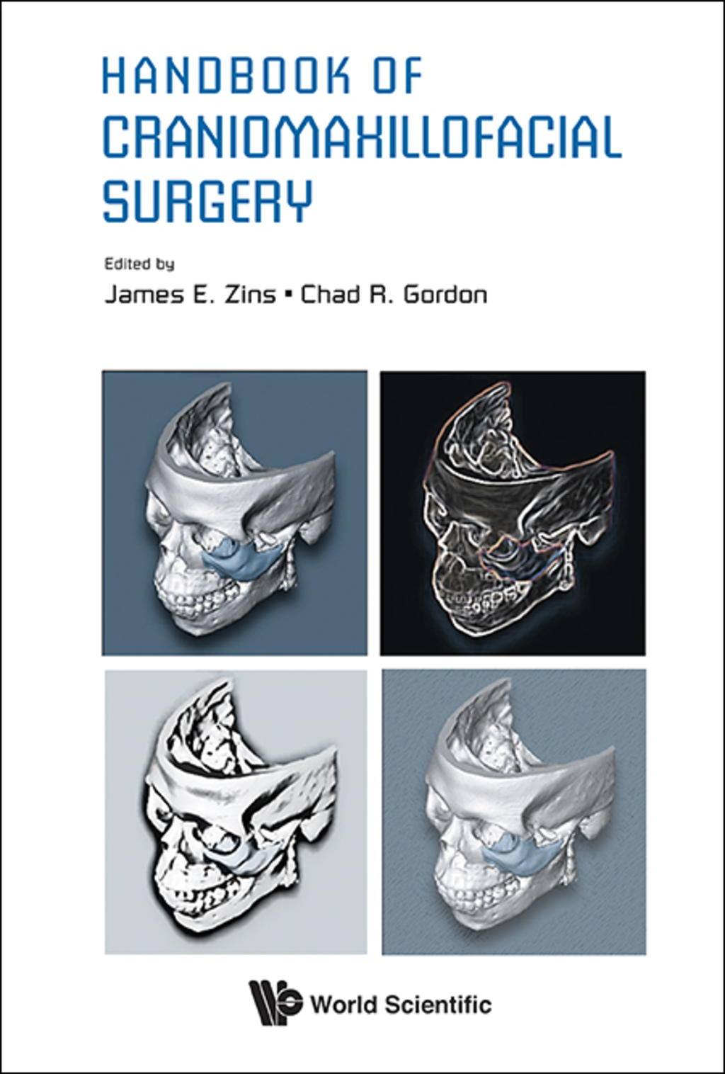 Handbook of Craniomaxillofacial Surgery 
