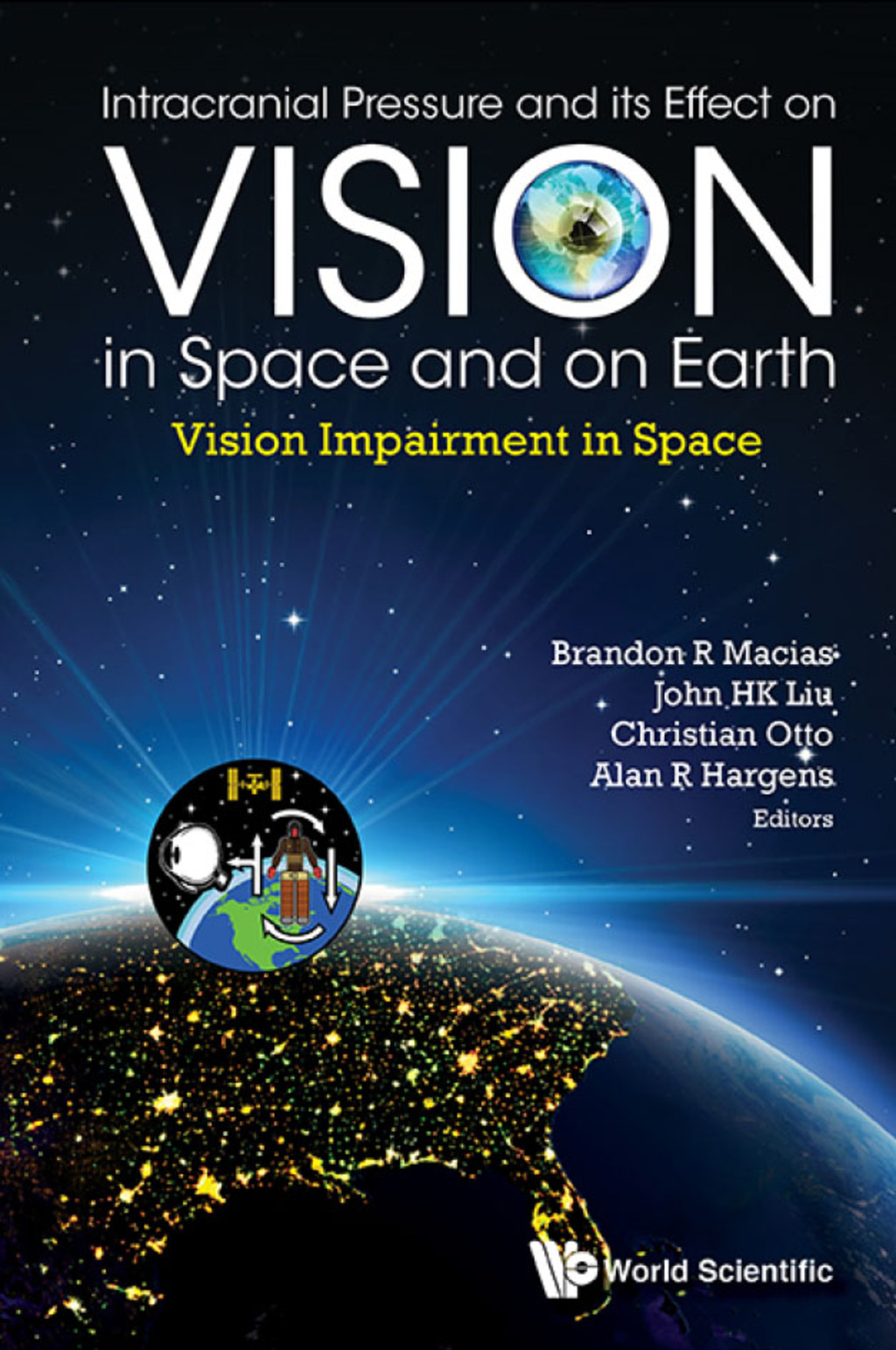 Intracranial Pressure and its Effect on Vision in Space and on Earth: Vision Impairment in Space 