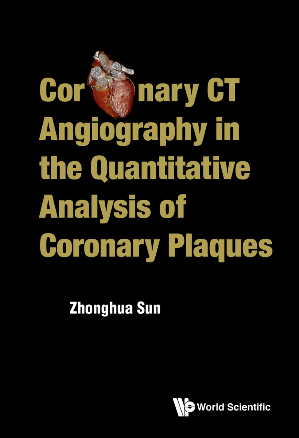 Coronary CT Angiography in the Quantitative Analysis of Coronary Plaques 