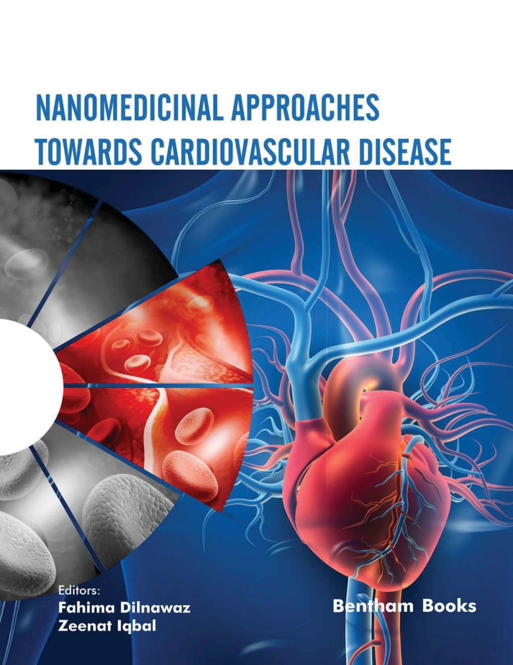 Nanomedicinal Approaches Towards Cardiovascular Disease 1st Edition