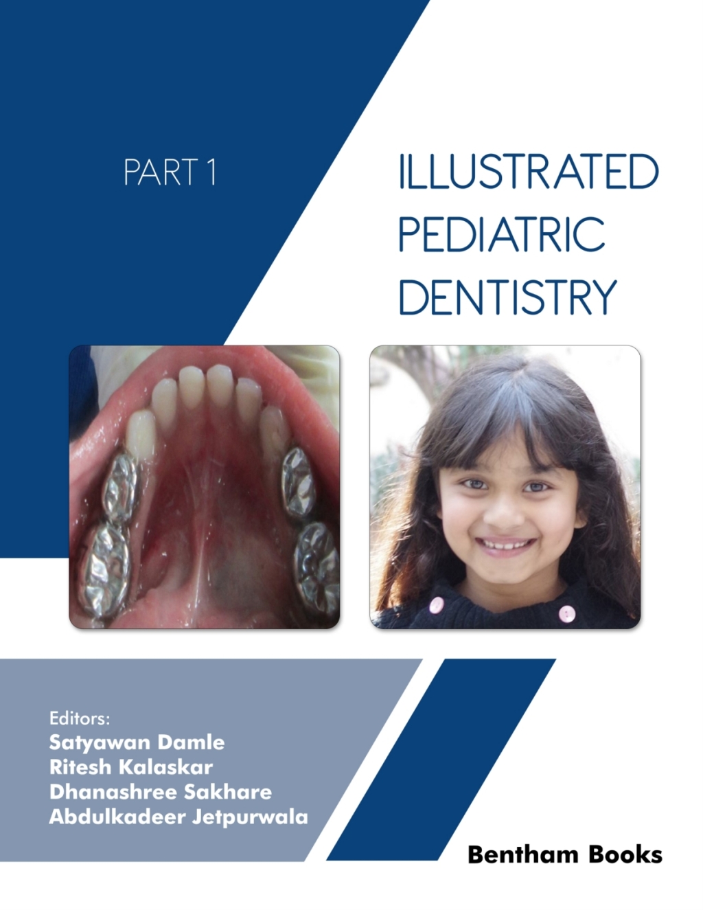 Illustrated Pediatric Dentistry (Part I) 1st Edition